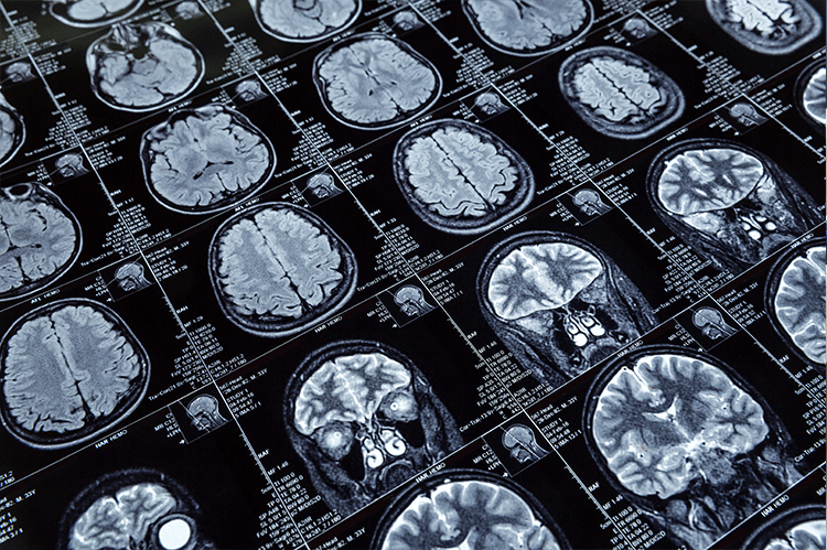 NMC-neuroradiology