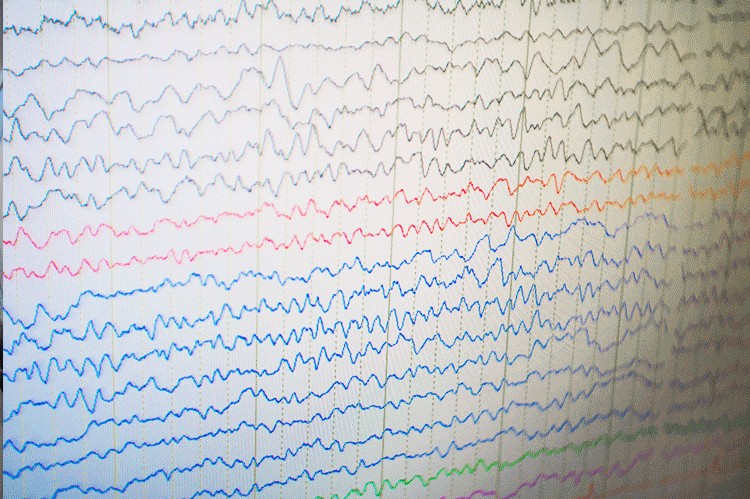 NeuroMedical-Center-Neurodiagnostic-Lab