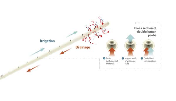 IRRAFlow Product Image